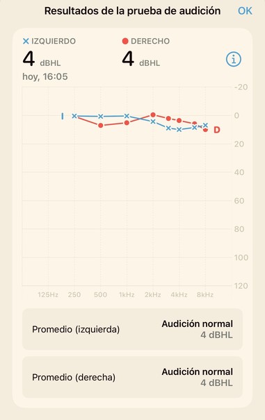Resultados de la prueba de audición
Promedio (izquierda)
Audición normal
4 dBHL
Promedio (derecha)
Audición normal
4 dBHL